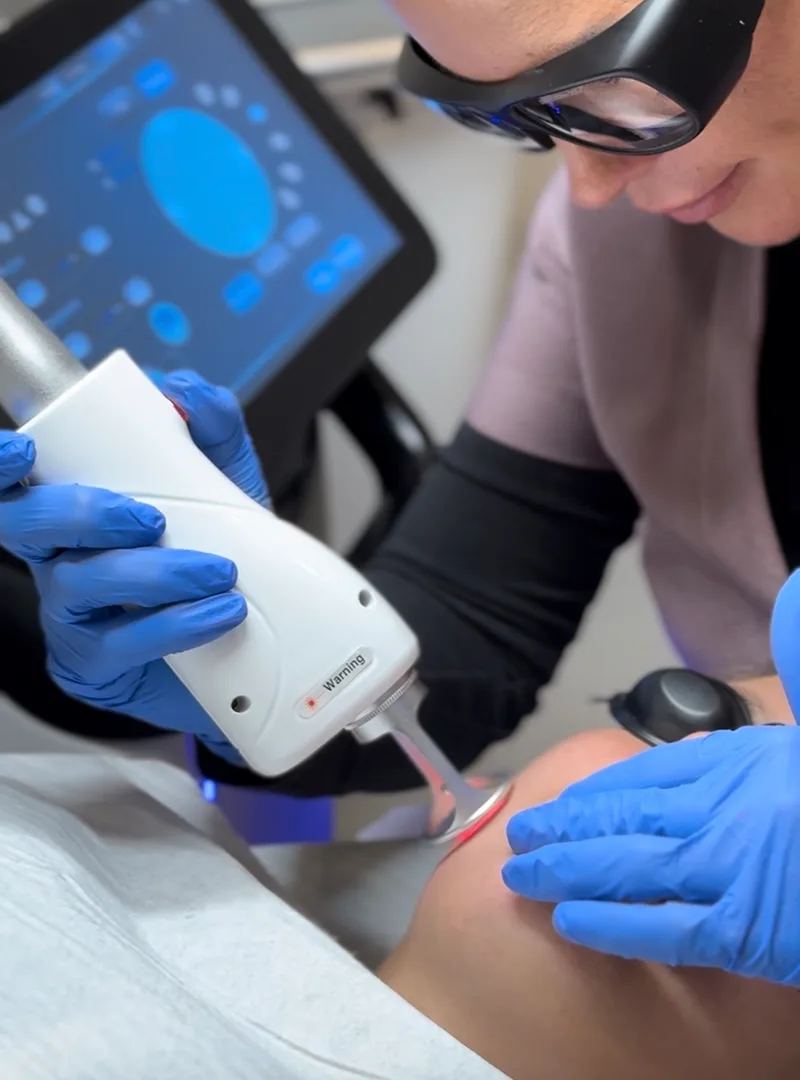 Zabieg-twarzy-laserem-tulowym Zabieg skóry twarzy z wykorzystaniem lasera tulowego